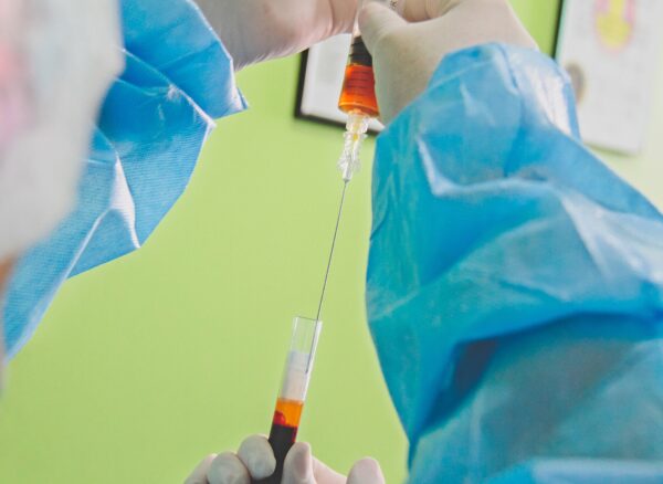 Tratamiento PRP